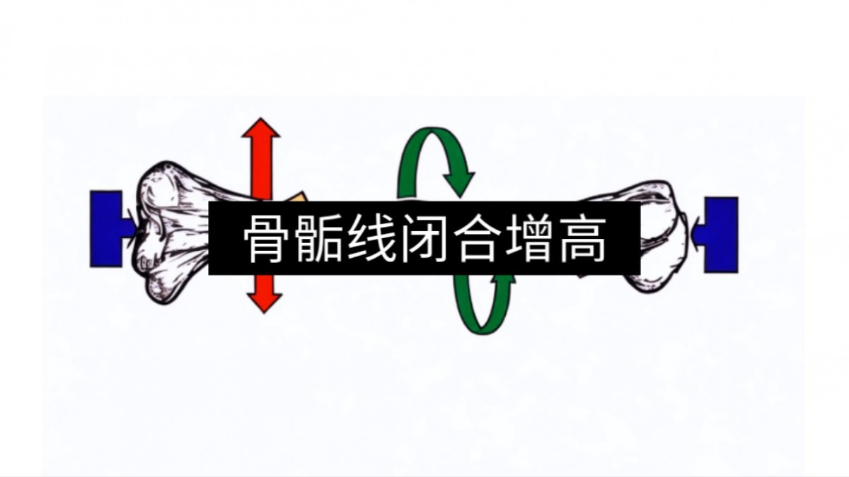 【想增高】成人(rén)增高項目火熱招募各地(dì / de)代理商，簽約增高3-15公分，無效全額退款