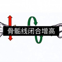 【想增高】成人(rén)增高項目火熱招募各地(dì / de)代理商，簽約增高3-15公分，無效全額退款