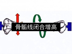 【想增高】成人(rén)增高項目火熱招募各地(dì / de)代理商，簽約增高3-15公分，無效全額退款
